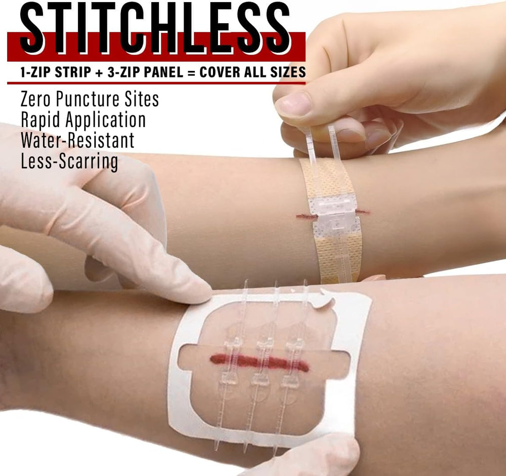 EVERLIT Wound Closure Pack | 4 Pcs Surgical Wound Zip Devices for Cut & L...