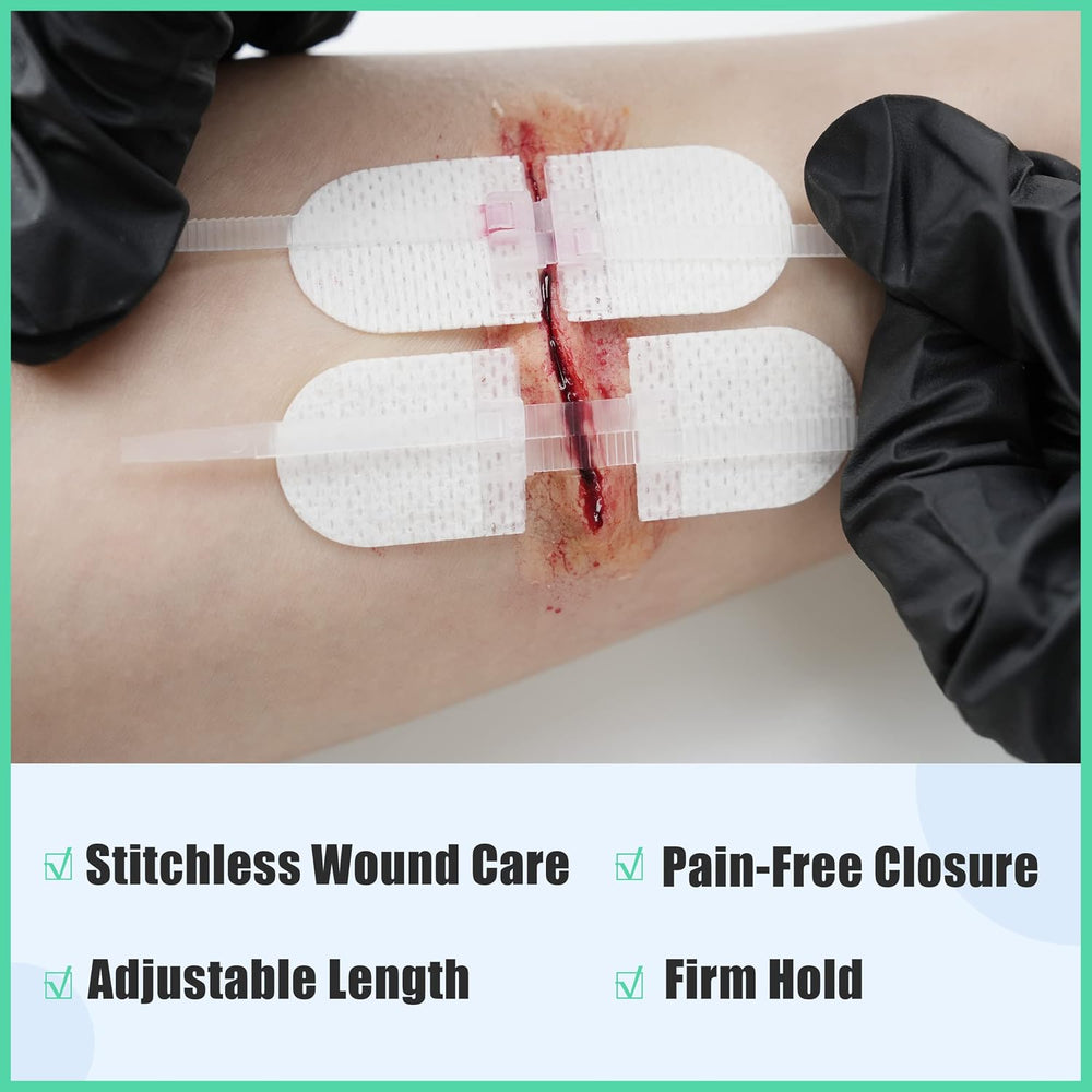 RHINO RESCUE Wound Closure Kit with 6 Stitch Zip Devices