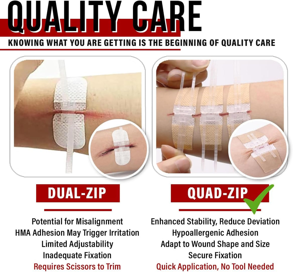 EVERLIT Wound Closure Pack | 4 Pcs Surgical Wound Zip Devices for Cut & L...