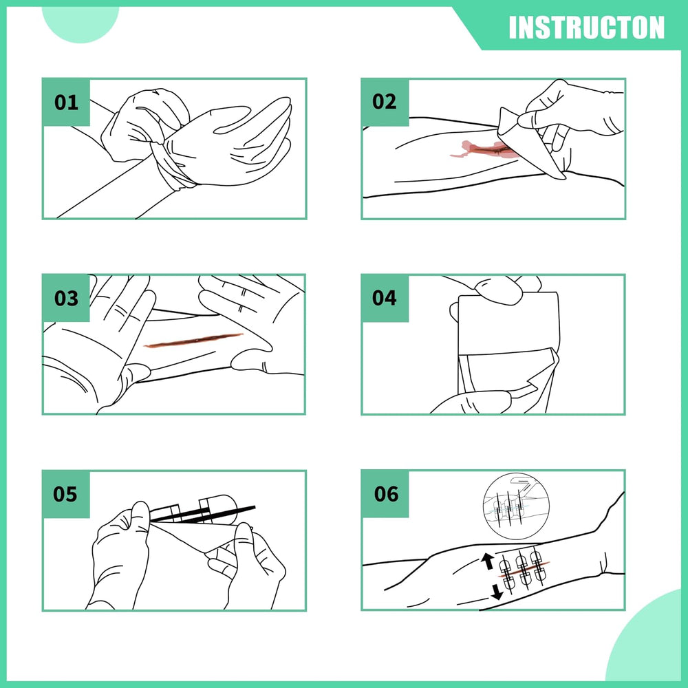 RHINO RESCUE Wound Closure Kit with 6 Stitch Zip Devices