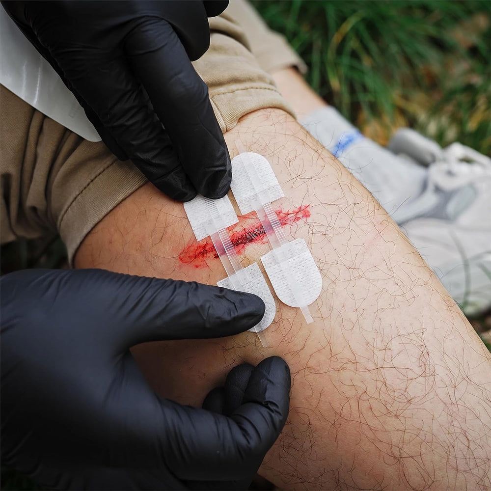 RHINO RESCUE Wound Closure Kit with 6 Stitch Zip Devices